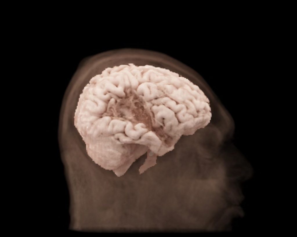 Act of Random Kindness - ENSURING FOUNDATIONAL FOOD SECURITY While Nourishing Minds and Reducing Disparities