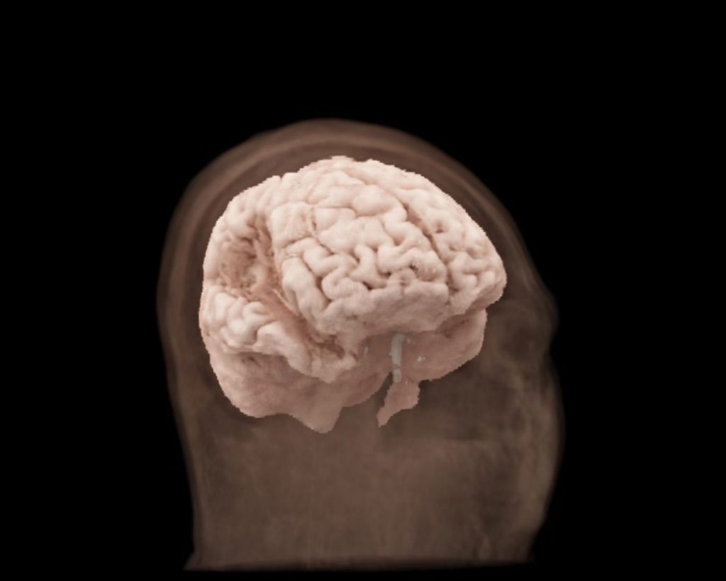 Act of Random Kindness - ENSURING FOUNDATIONAL FOOD SECURITY While Nourishing Minds and Reducing Disparities