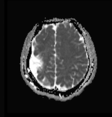 Act of Random Kindness - ENSURING FOUNDATIONAL FOOD SECURITY While Nourishing Minds and Reducing Disparities