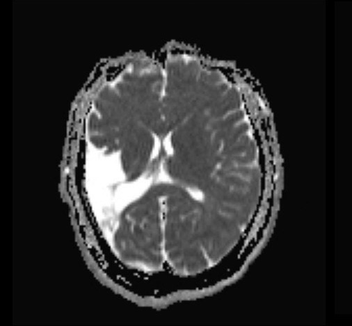 Act of Random Kindness - ENSURING FOUNDATIONAL FOOD SECURITY While Nourishing Minds and Reducing Disparities